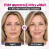 NovaSkin™ – Wygładź zmarszczki i blizny w 14 dni