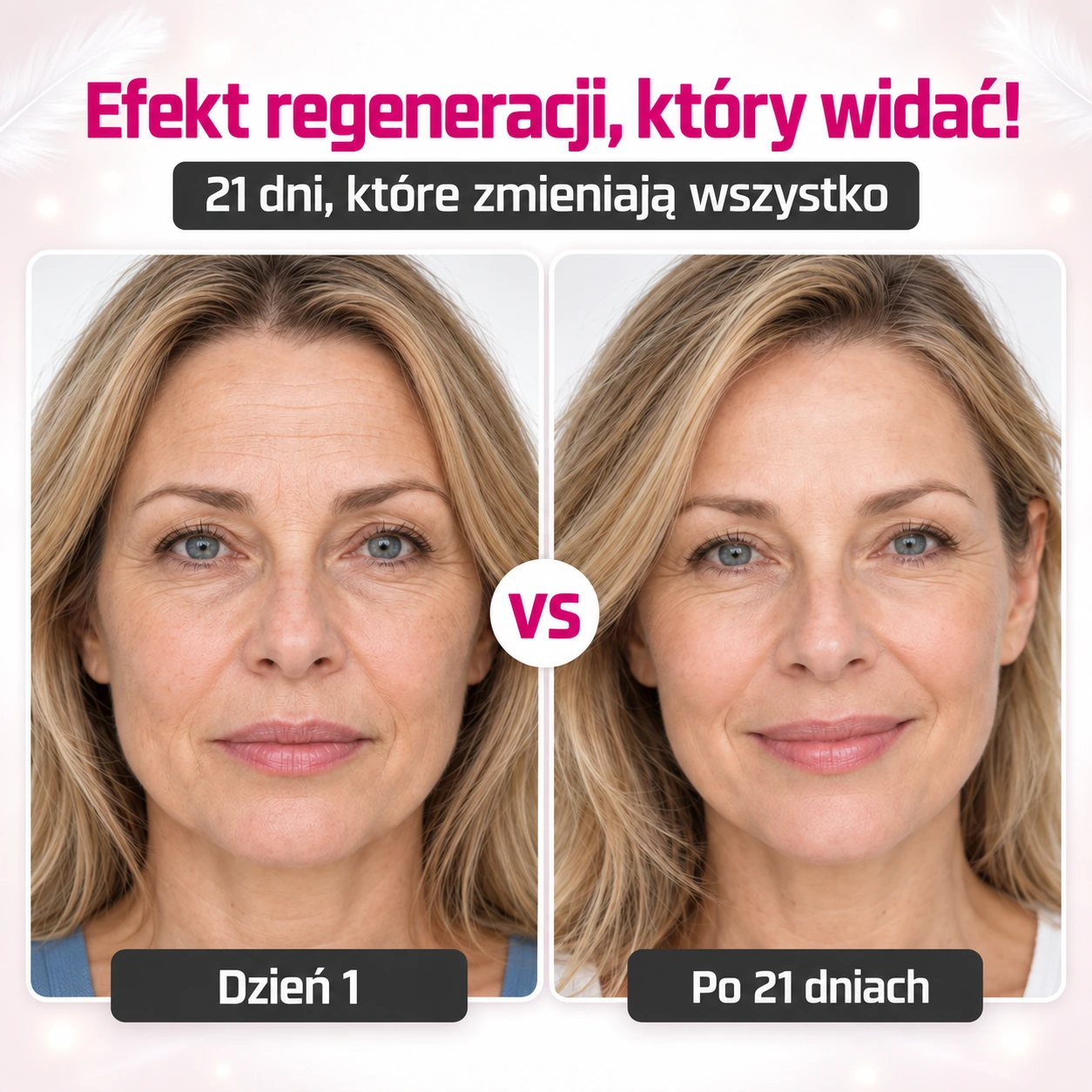 NovaSkin™ – Wygładź zmarszczki i blizny w 14 dni