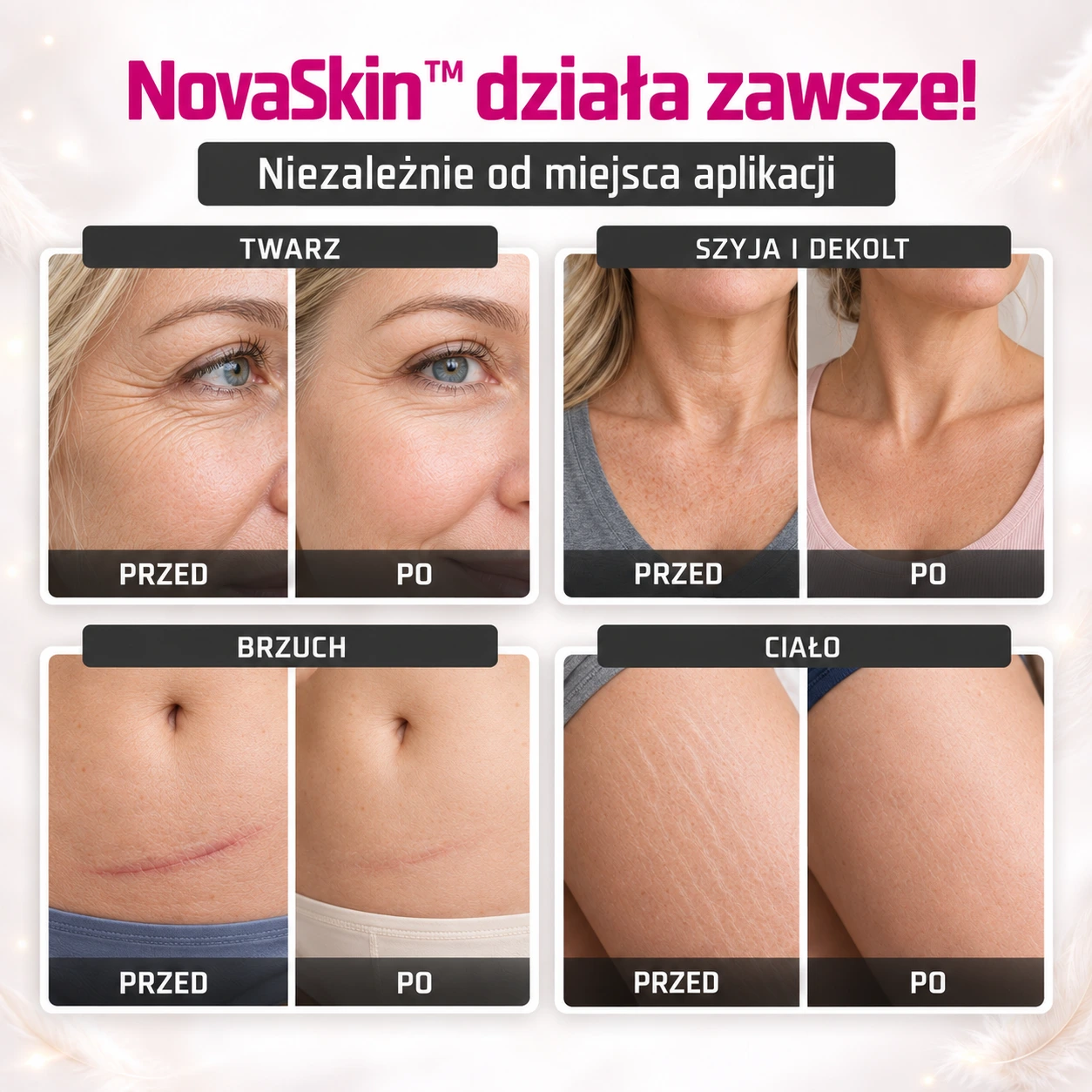 NovaSkin™ – Wygładź zmarszczki i blizny w 14 dni